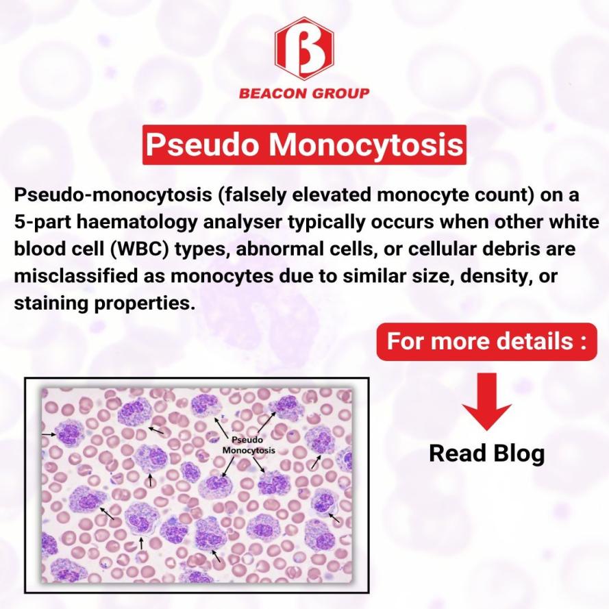 Pseudo Monocytosis in Automated Hematology Analyzers