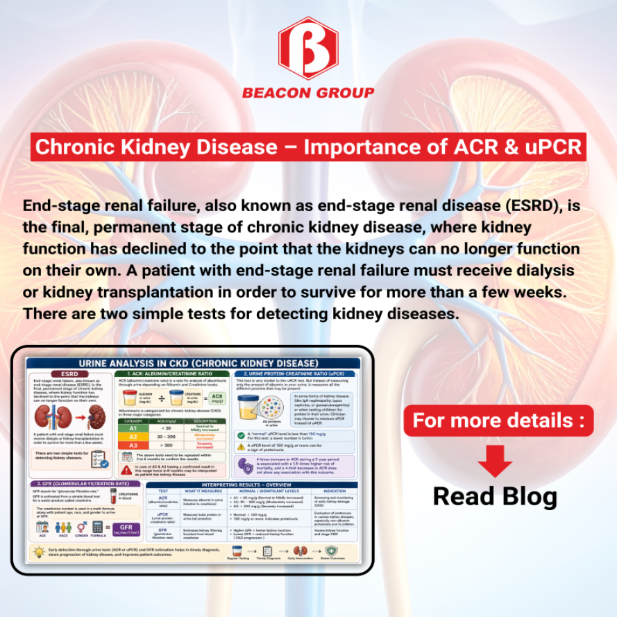 Chronic Kidney Disease – Importance of ACR & uPCR